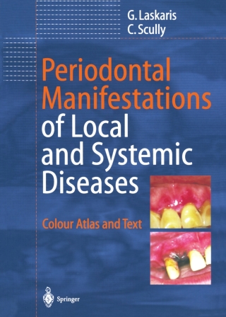 Periodontal Manifestations of Local and Systemic Diseases