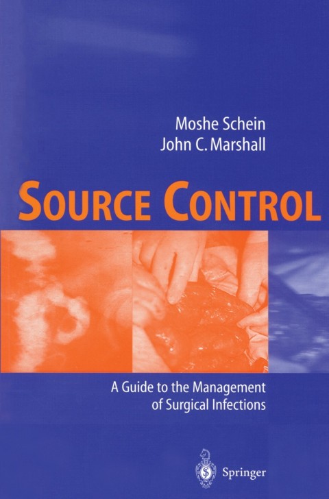 Source Control 
