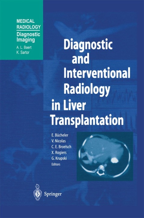 Cover image for book Diagnostic and Interventional Radiology in Liver Transplantation