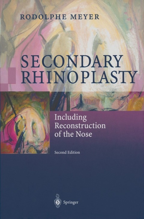 Cover image for book Secondary Rhinoplasty