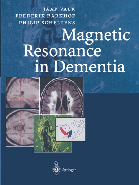 Magnetic Resonance in Dementia 