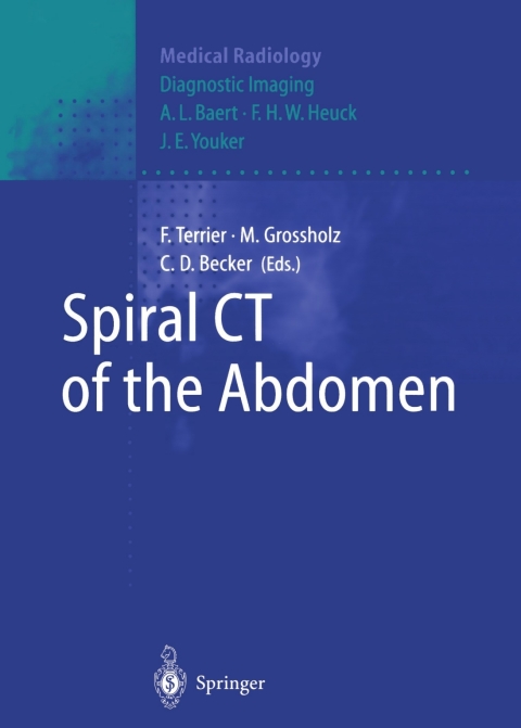 Cover image for book Spiral CT of the Abdomen