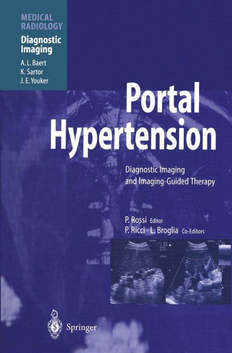 Portal Hypertension 