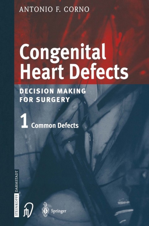 Cover image for book Congenital Heart Defects