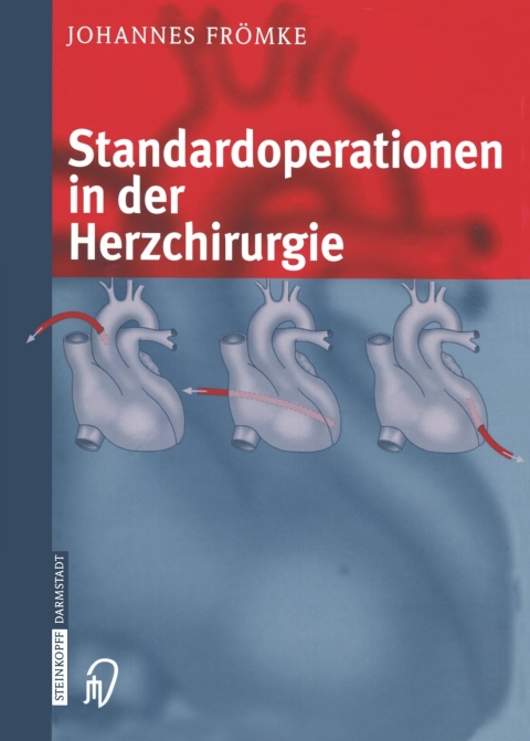 Cover image for book Standardoperationen in der Herzchirurgie