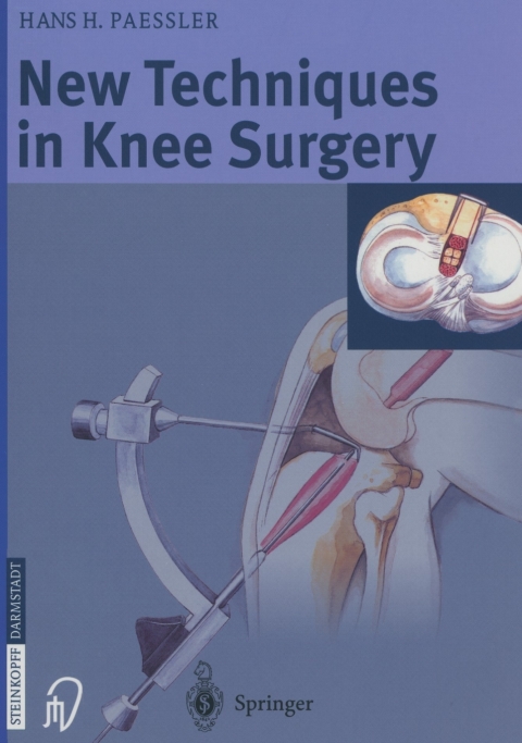 Cover image for book New Techniques in Knee Surgery