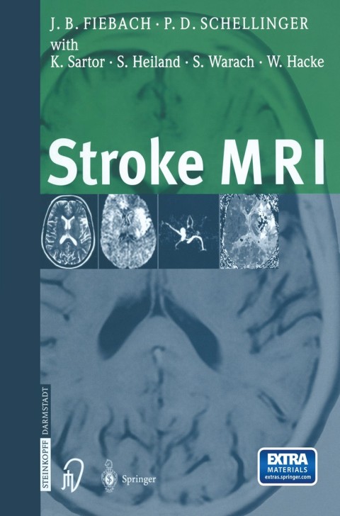 Cover image for book Stroke MRI