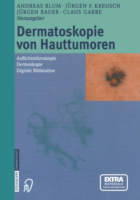 Cover image for book Dermatoskopie von Hauttumoren