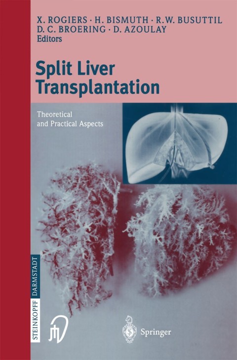 Cover image for book Split liver transplantation