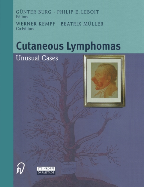 Cover image for book Cutaneous Lymphomas