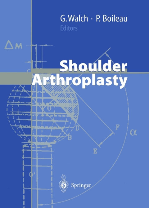 Cover image for book Shoulder Arthroplasty