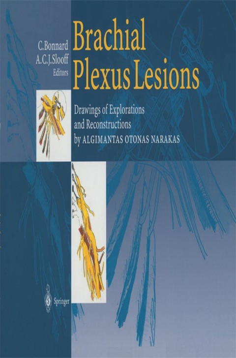 Cover image for book Brachial Plexus Lesions
