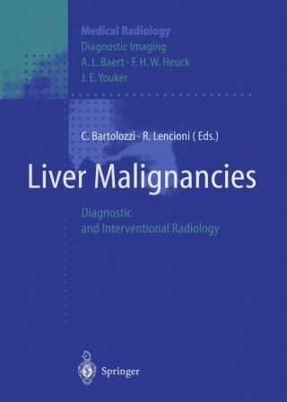 Liver Malignancies