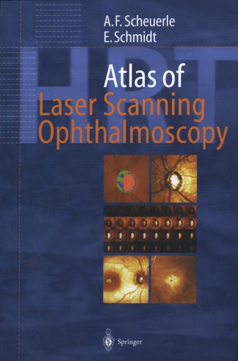 Atlas of Laser Scanning Ophthalmoscopy 