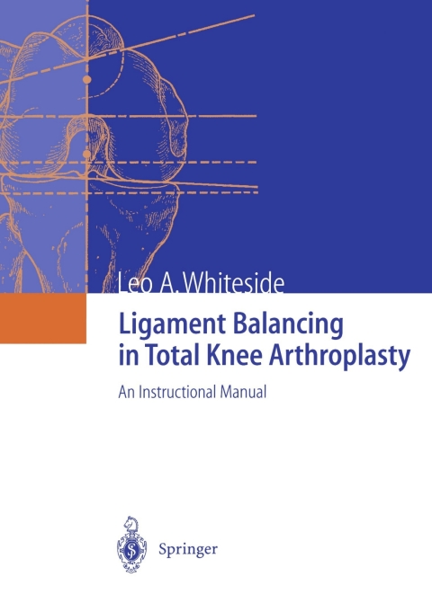 Cover image for book Ligament Balancing in Total Knee Arthroplasty