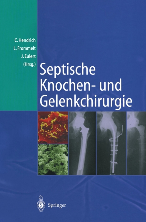 Cover image for book Septische Knochen-und Gelenkchirurgie