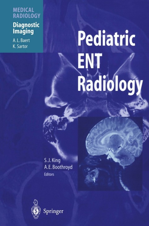 Cover image for book Pediatric ENT Radiology