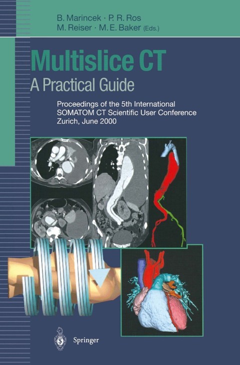 Cover image for book Multislice CT: A Practical Guide