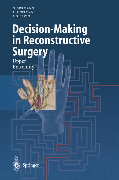 Decision-Making in Reconstructive Surgery 