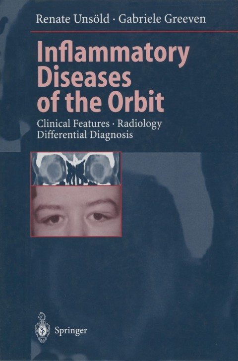 Cover image for book Inflammatory Diseases of the Orbit