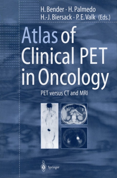 Cover image for book Atlas of Clinical PET in Oncology