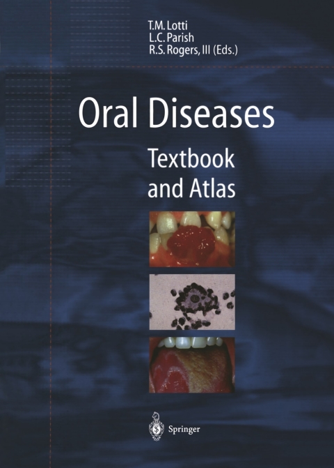 Cover image for book Oral Diseases