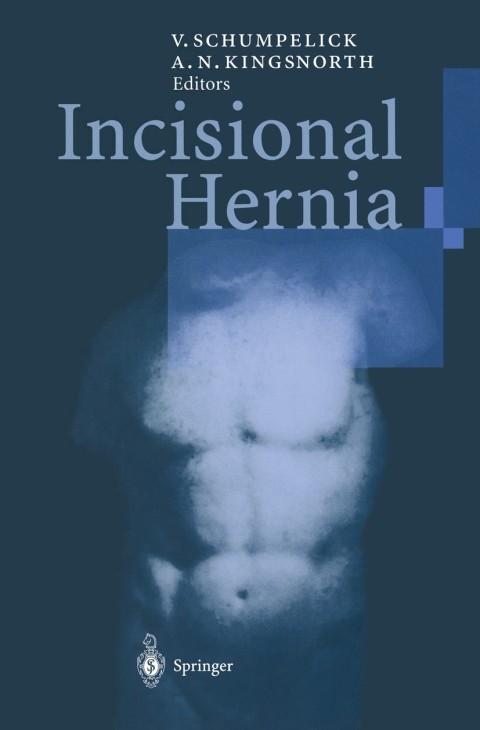 Cover image for book Incisional Hernia