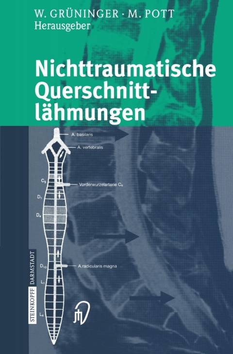 Cover image for book Nichttraumatische Querschnittlähmungen