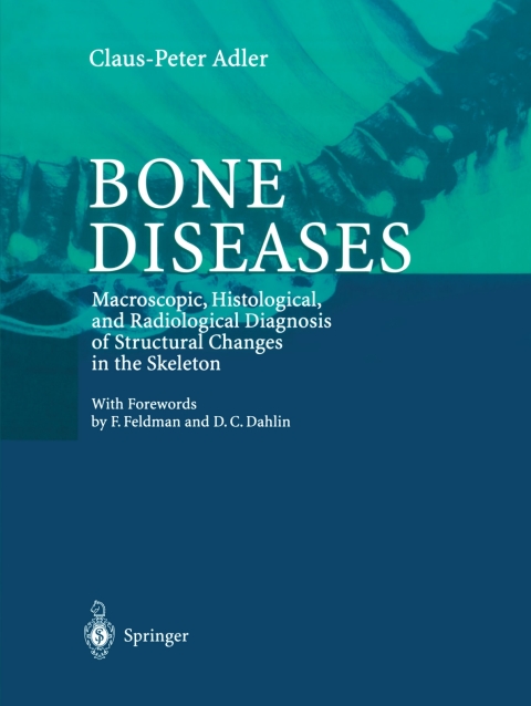 Cover image for book Bone Diseases
