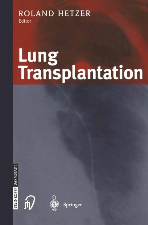 Cover image for book Lung Transplantation