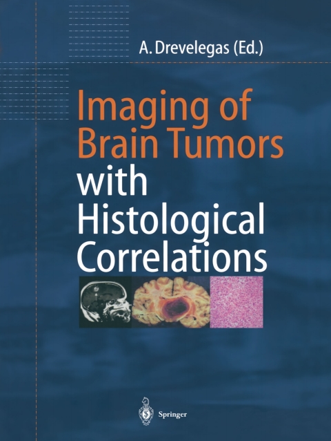 Cover image for book Imaging of Brain Tumors with Histological Correlations