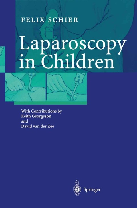 Cover image for book Laparoscopy in Children