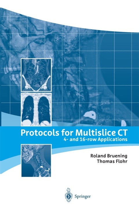 Cover image for book Protocols for Multislice CT