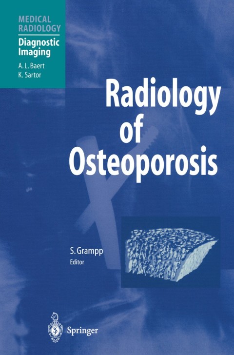 Cover image for book Radiology of Osteoporosis