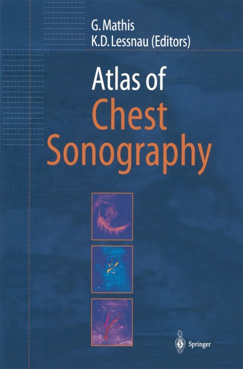 Cover image for book Atlas of Chest Sonography