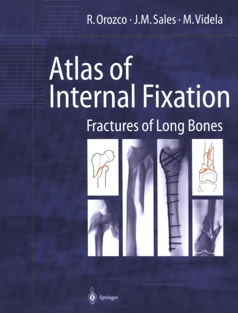 Cover image for book Atlas of Internal Fixation