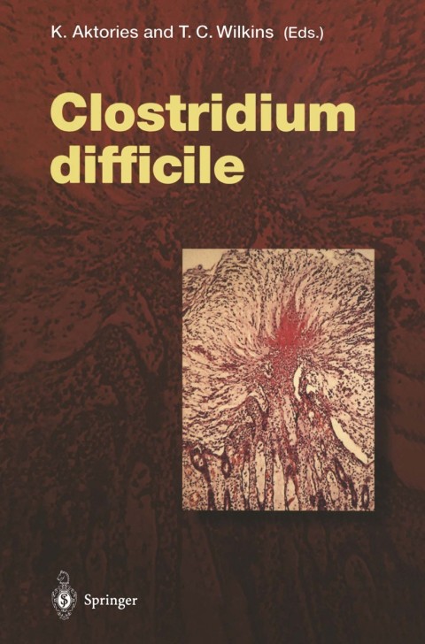 Cover image for book Clostridium difficile