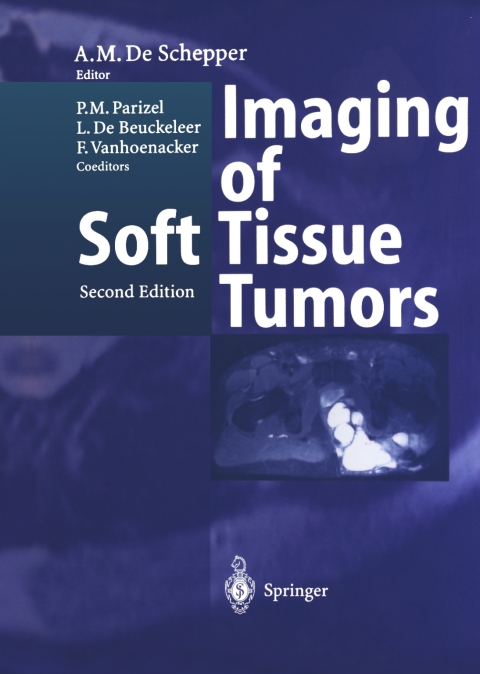 Cover image for book Imaging of Soft Tissue Tumors