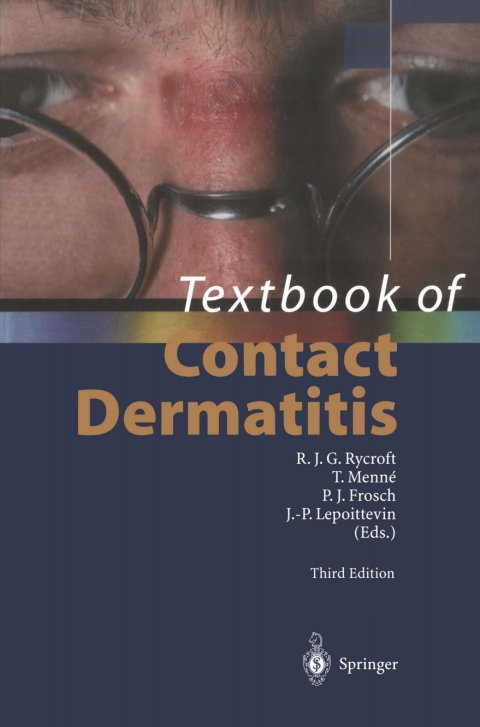 Cover image for book Textbook of Contact Dermatitis