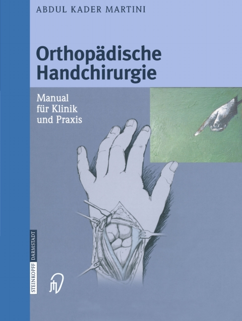 Cover image for book Orthopädische Handchirurgie