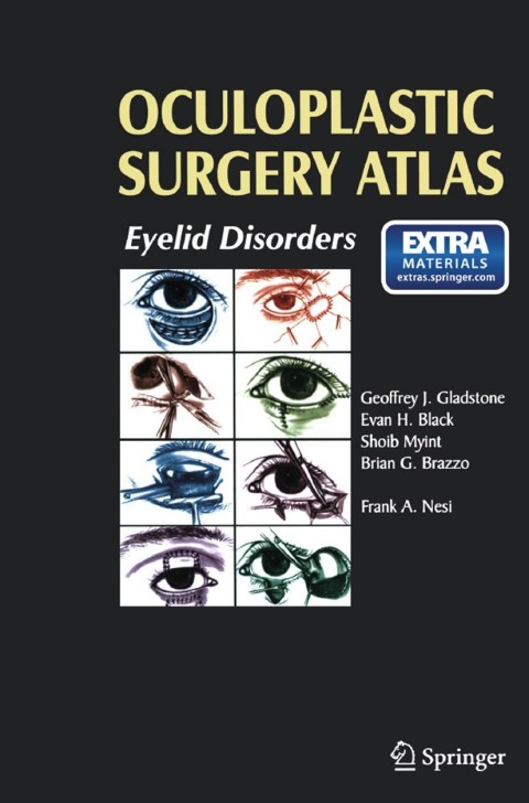 Oculoplastic Surgery Atlas 