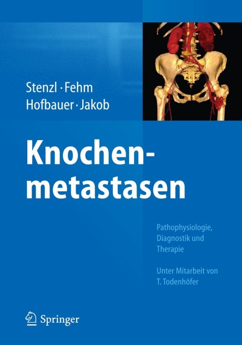 Cover image for book Knochenmetastasen