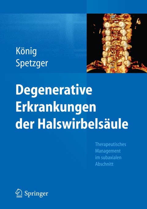 Cover image for book Degenerative Erkrankungen der Halswirbelsäule