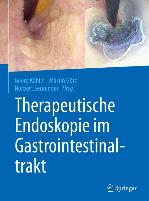 Cover image for book Therapeutische Endoskopie im Gastrointestinaltrakt