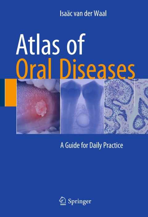 Cover image for book Atlas of Oral Diseases