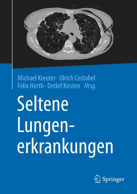 Cover image for book Seltene Lungenerkrankungen