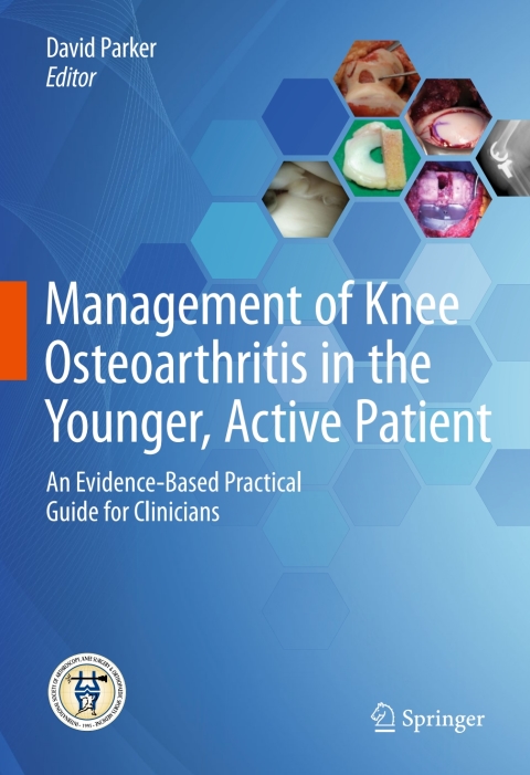 Cover image for book Management of Knee Osteoarthritis in the Younger, Active Patient