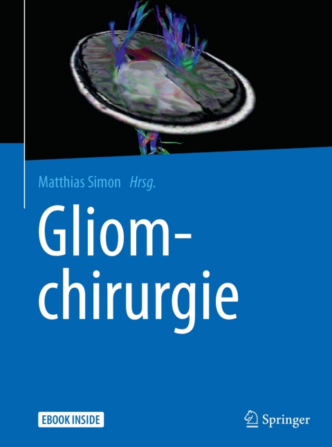 Cover image for book Gliomchirurgie
