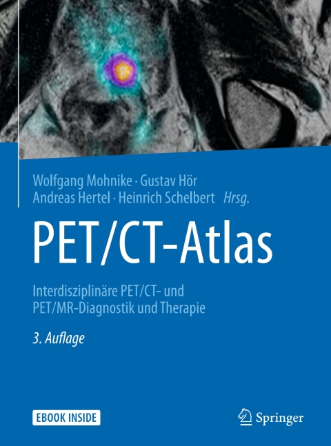 Cover image for book PET/CT-Atlas