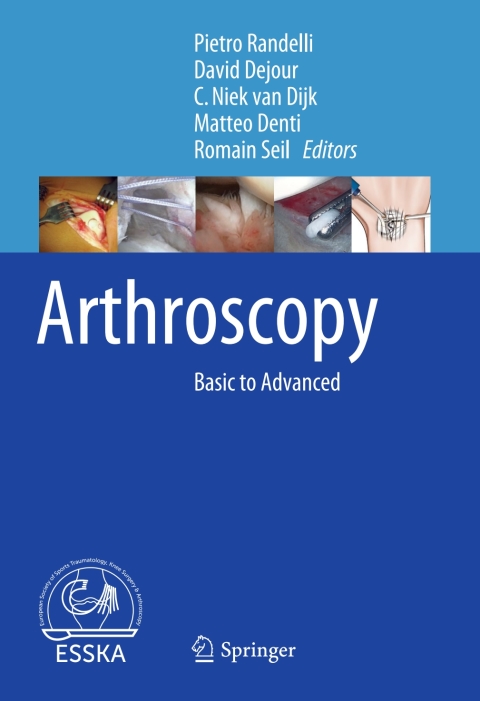 Cover image for book Arthroscopy